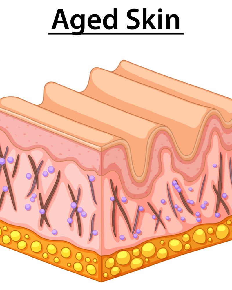 ilustracion_piel_envejecida